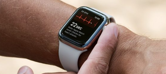 新的Apple  Watch应该具有监视血糖的功能